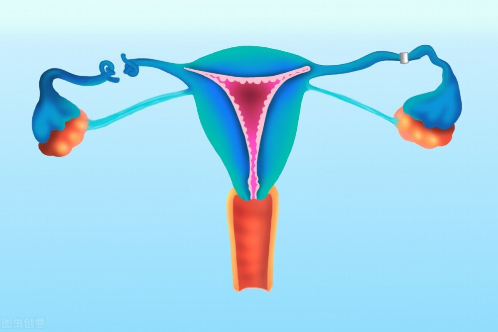 输卵管堵塞合并输卵管水肿，试管前要切除或是