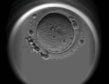 试管婴儿胚胎等级不好=不能怀孕？人不可貌相，