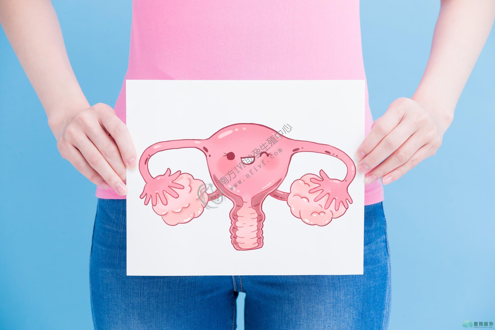 子宫内膜异位症意味着什么以及如何更好地治疗它